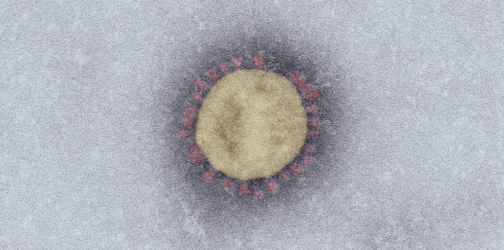 SARS-Coronavirus-2 (SARS-CoV-2, Isolat SARS-CoV-2/Italy-INMI1). Elektronenmikroskopie, Negativkontrastierung (PTA). Maßstab: 100 nm. Quelle: Robert Koch-Institut